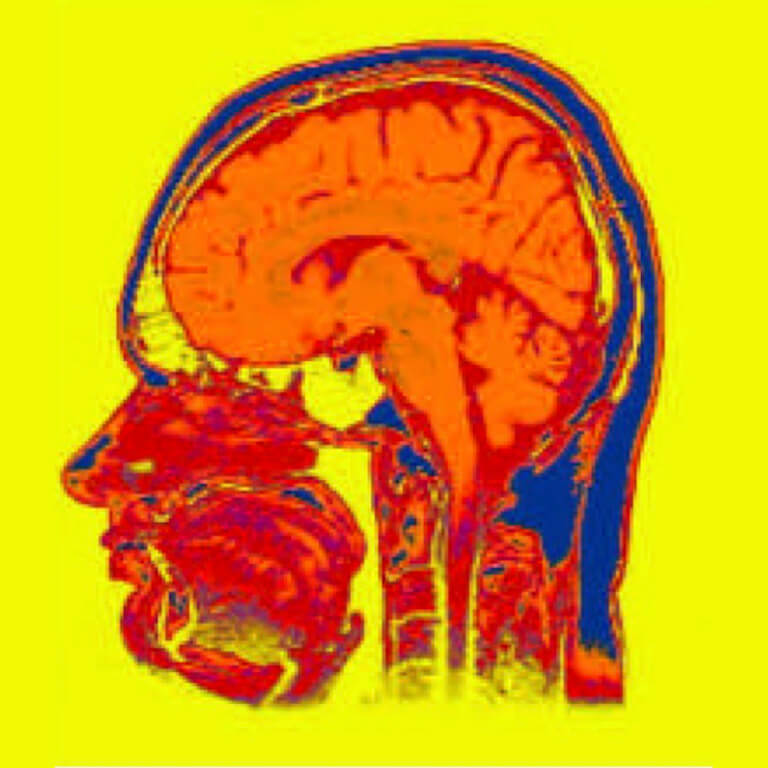 MRT picture of an human head: wikipedia.org, 16.11.2012